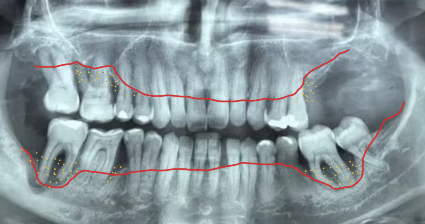Rascunho automático