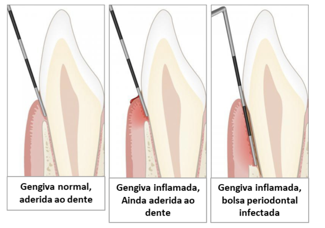 Rascunho automático